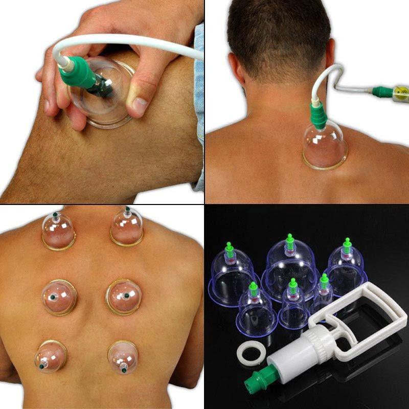 KL Θεραπευτική Συσκευή με Βεντούζες 24τμχ - Pull Out A Vacuum Apparatus 24pcs OEM